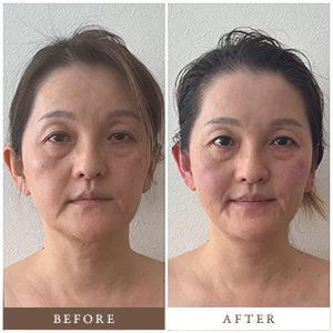 目元のビフォーアフター